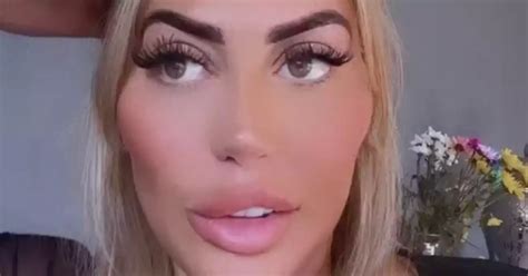 Chloe Ferry warns against fox eye surgery after 